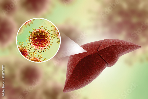 Hepatitis c virus infection. Liver disease. 3d illustration photo