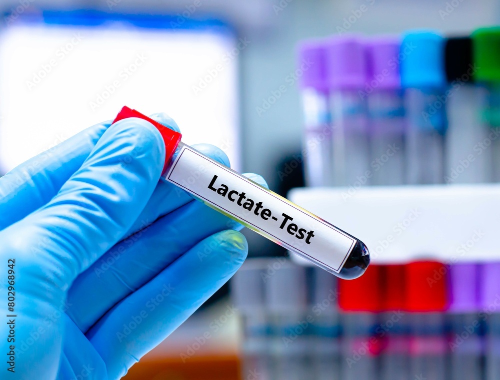Blood samping tube for lactate test analysis. Blood samping tube for lactate test analysis.