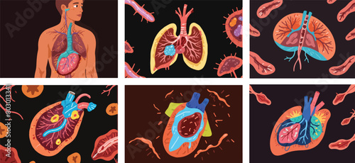 Vector Illustration of Liver Inflammation - Understanding Hepatitis and Its Health Implications.
