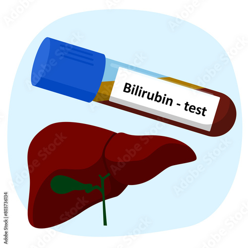 bilirubin test photo