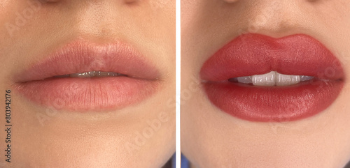collage of permanent makeup on the lips of a young woman of a delicate peach shade close-up, a girl before and after a cosmetic procedure with smooth and clean healthy skin.