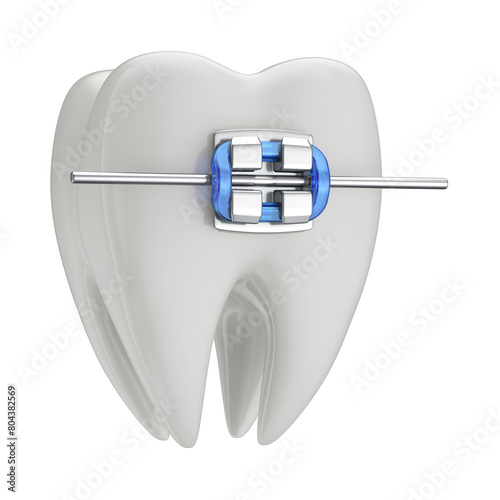 Tooth with braces in 3d isolated transparent background. Tooth 3d icon. Health, dental clinic or dentist symbol.