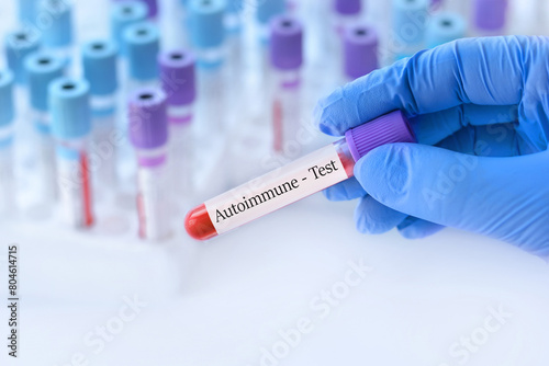 Doctor holding a test blood sample tube with Autoimmune test on the background of medical test tubes with analyzes.