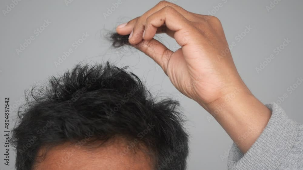 hair loss concept with man checking his hair hair loss concept with man checking his hair