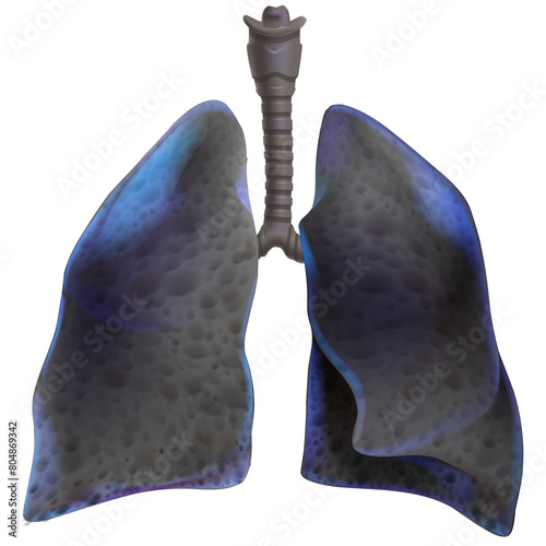 3D illustration of two lungs with cancer in the final stages where the lung tissue has turned black. Used in medicine, education, science. Commercial and industrial.