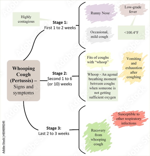 Whooping cough (pertussis) - Signs and symptoms