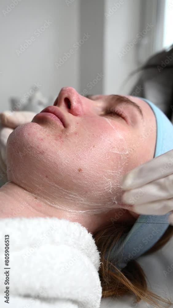 Close up of ultrasound skin cleaning and facial peeling procedure in beauty clinic. Macro shot of woman under procedure of ultrasonic facial. Deep pore cleansing treatment Close up of ultrasound skin cleaning and facial peeling procedure in beauty clinic. Macro shot of woman under procedure of ultrasonic facial. Deep pore cleansing treatment