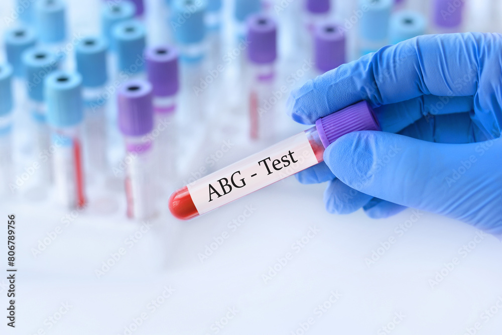 Fototapeta premium Doctor holding a test blood sample tube with ABG test on the background of medical test tubes with analyzes.