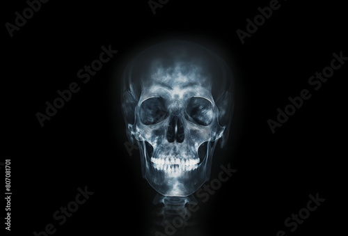 X-ray film human s skull and cervical spine lateral view  close up