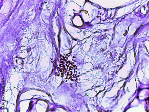 photo of cross section in small intestine jejunum as seen by the microscope photo