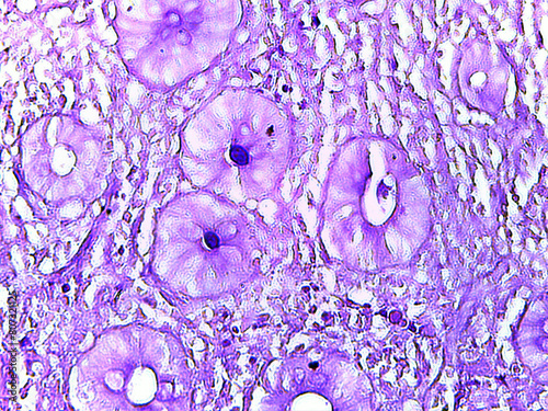 photo of cross section in small intestine jejunum as seen by the microscope photo