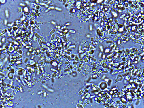 photo of fungi spores and mycelium under the microscope