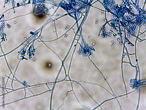 Konstfotografi photo of fungi mold mycelium growth and spores under the microscope
