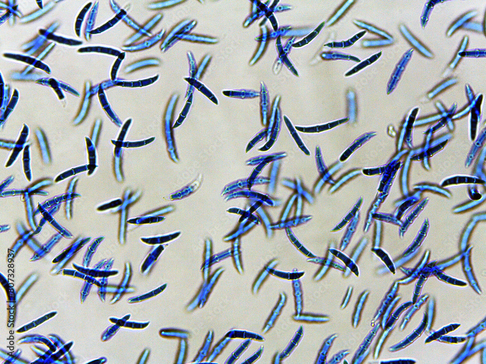 photo of fungi mold mycelium growth and spores under the microscope photo of fungi mold mycelium growth and spores under the microscope