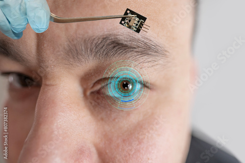 Canvas Print Installing electronic chip into human bionic, neuroprosthetic eye, cutting-edge