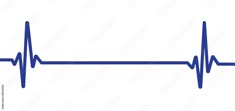 Electrocardiogram, EKG monitoring in an emergency. End of the life-beat line. Vector illustration with editable stroke. eps 10 Electrocardiogram, EKG monitoring in an emergency. End of the life-beat line. Vector illustration with editable stroke. eps 10