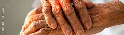 Elderly persons swollen arthritic hands gently massaged by caregiver, muscle inflammation due to chronic condition in home photo