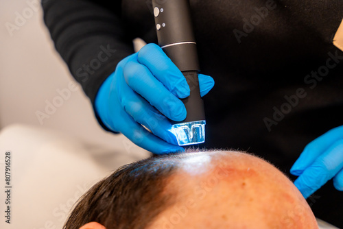 Obraz na płótnie Man at the spa getting an baldness treatment with laser
