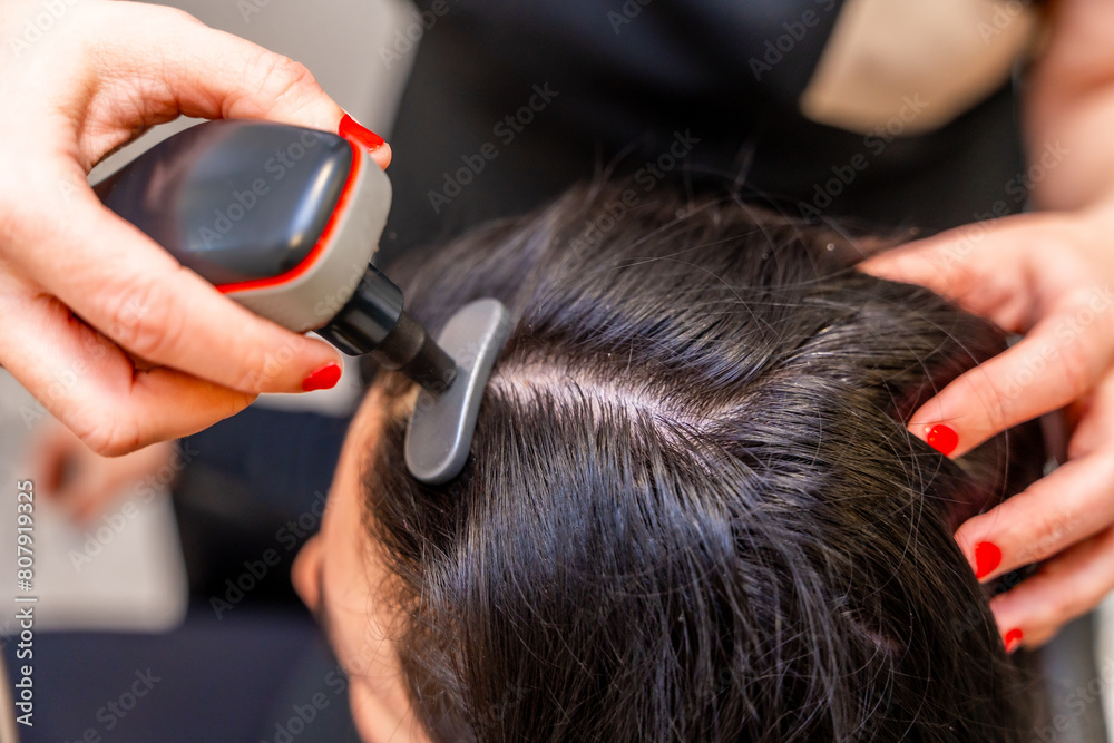 Naklejka premium Woman receiving modern treatment to combat hair loss