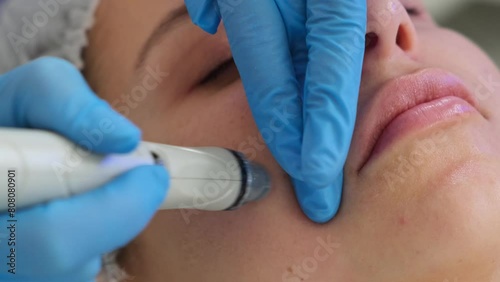 Professional moisturizing and rejuvenating hardware procedure. Hydrafacial massage process. Close-up shot of a young woman receiving microdermabrasion therapy at beauty spa. photo