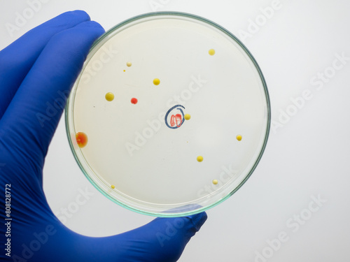 An isolated colony of bacteria on a petri dish, different colonies of bacteria on a test edit.