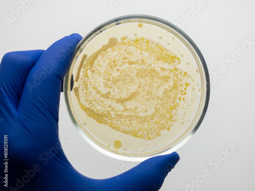 A petri dish with colonies of yellow bacteria on a gray background, the doctor holds the dish in his hand.