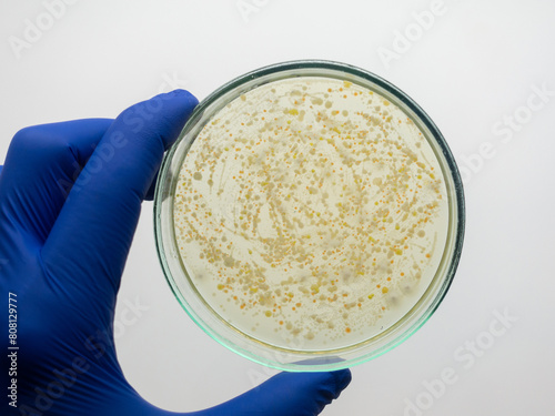 Many colonies of bacteria grew on a nutrient medium in a petri dish. photo