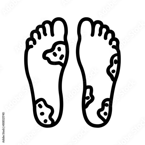 Vector black line icon for Calluses
