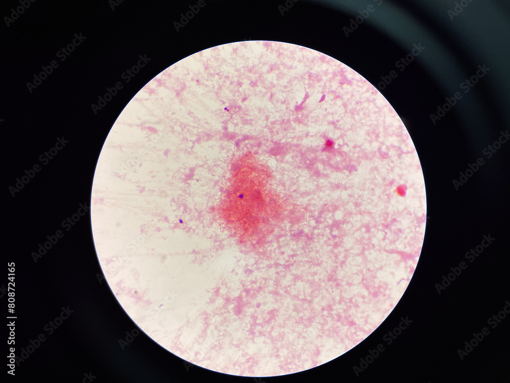 red bacteria cell branching in hemoculture. red bacteria cell branching in hemoculture.