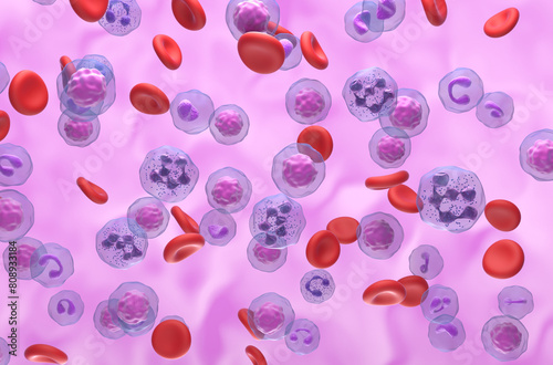 Hypersegmented neutrophil in WHIM Syndrome - isometric view 3d illustration