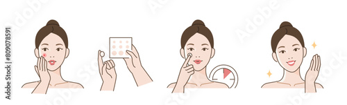 Skincare illustrations set. Collection of girl with problem skin applying pimple patch or absorbing pad on her face. Skin care routine and acne treatment concept. Vector illustration. © Irina Strelnikova