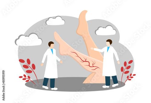 Varicose veins. Vascular Surgeon. Vector