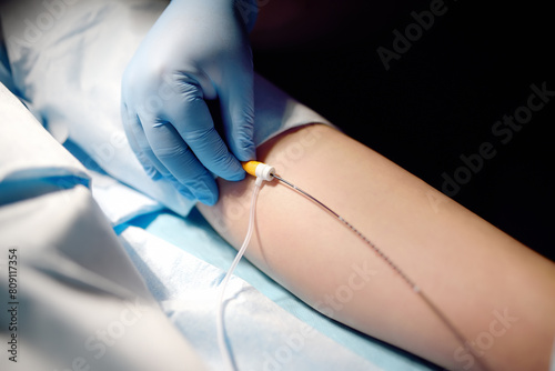 Professional vascular surgeon is in the operating room of the clinic during vein surgery. Phlebectomy. Modern technology of deep vein thrombosis treatment. photo