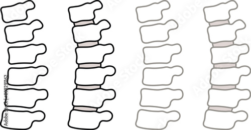 Simple Cartoon Human Spine Vertebrae Section with Discs Clipart Drawing - Color