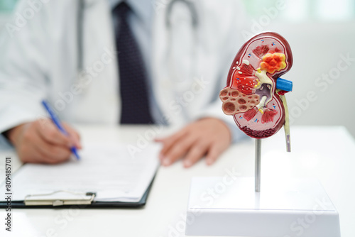 Chronic kidney disease, doctor with model for treatment urinary system, urology, Estimated glomerular filtration rate eGFR. photo