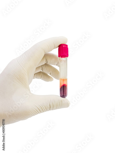 Blood test in the laboratory,The doctor's hands are wearing gloves and holding a clotted blood tube to collect a sample for testing in the laboratory transparent background.Health service concept 