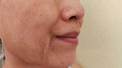 close up the wrinkle and Flabby skin, smile lines beside the mouth, Flabbiness and loose on the face, dark spots and blemish, freckles and ages skin of the woman, health care and beauty concept. photo