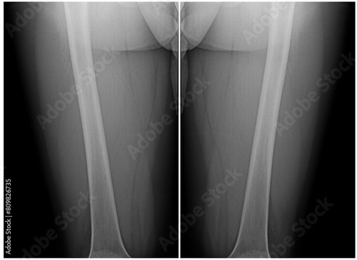 X-ray images are mirror-symmetrically arranged