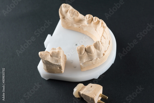 ceramic dental crown