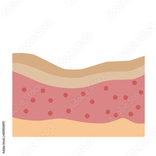 Human Skin Layer Illustration 