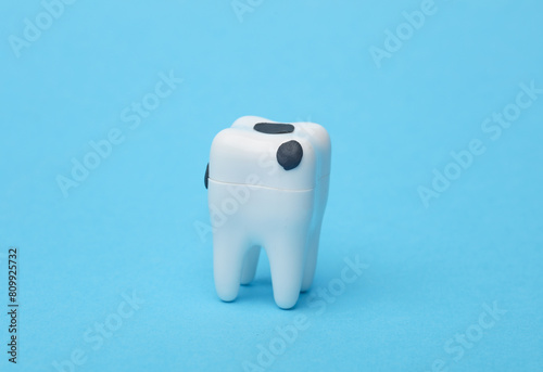 Model of a tooth affected by caries on blue background. Dental treatment