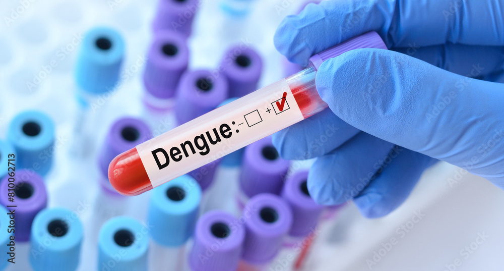Fototapeta premium Doctor holding a test blood sample tube with Dengue test on the background of medical test tubes with analyzes.