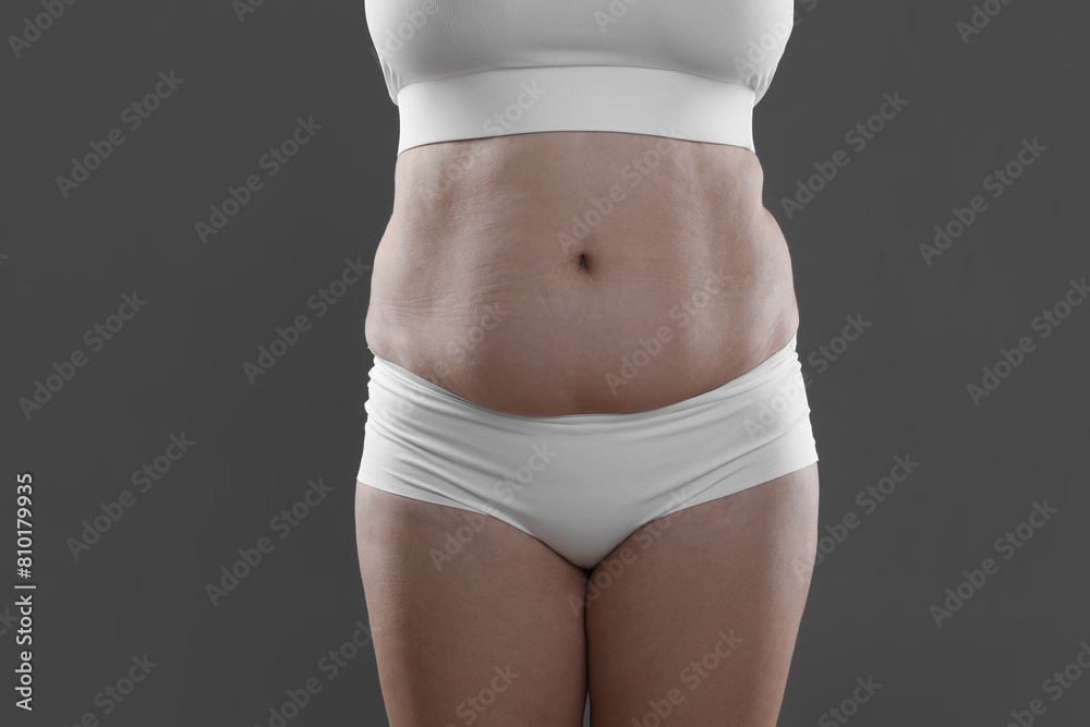 Fototapeta premium Woman with excessive belly fat on grey background, closeup. Overweight problem