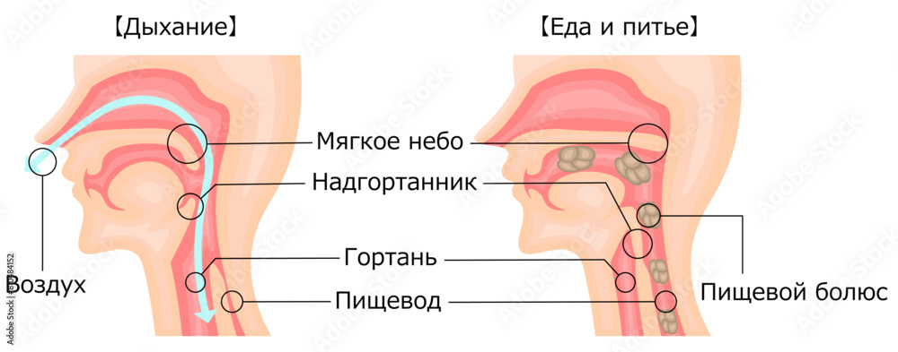 Obraz premium 飲食 呼吸 嚥下性無呼吸 イラスト ロシア語