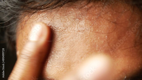 closeup of sweat on forehead against dark background , photo