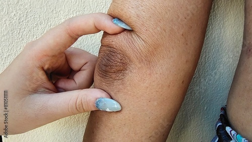 close up the black elbow, wrinkle and Flabby skin on the arm, Flabbiness and loose on the body, health care and medical concept.