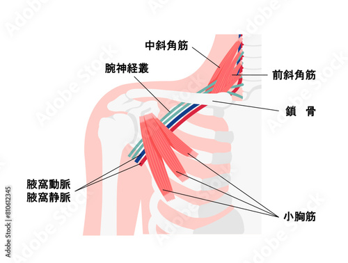 胸郭出口症候群の発生する部位の図解 イラスト