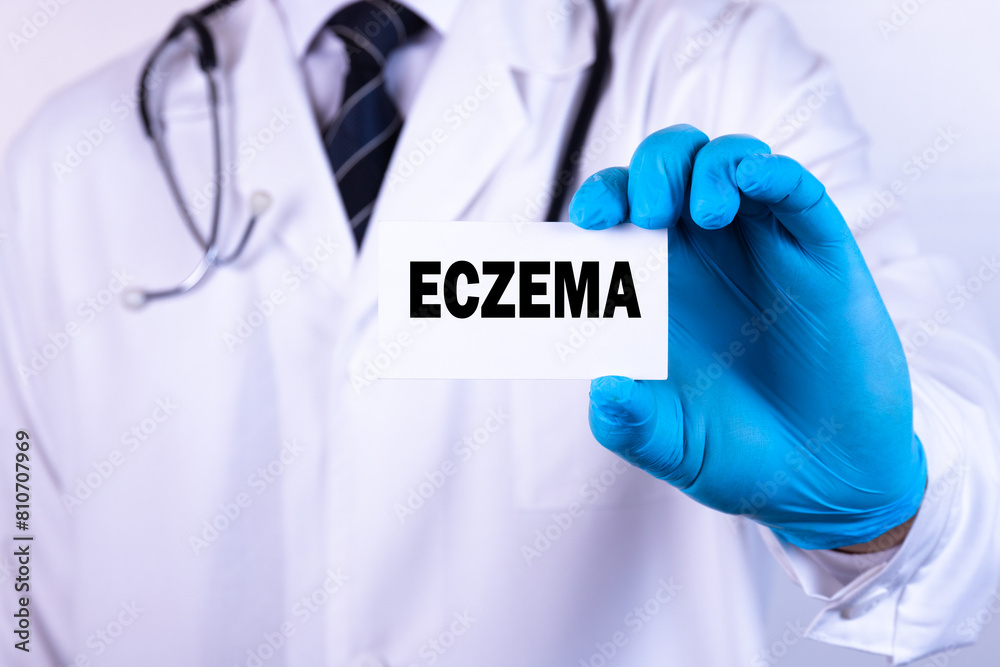 Doctor holding a card with text Eczema medical concept Doctor holding a card with text Eczema medical concept