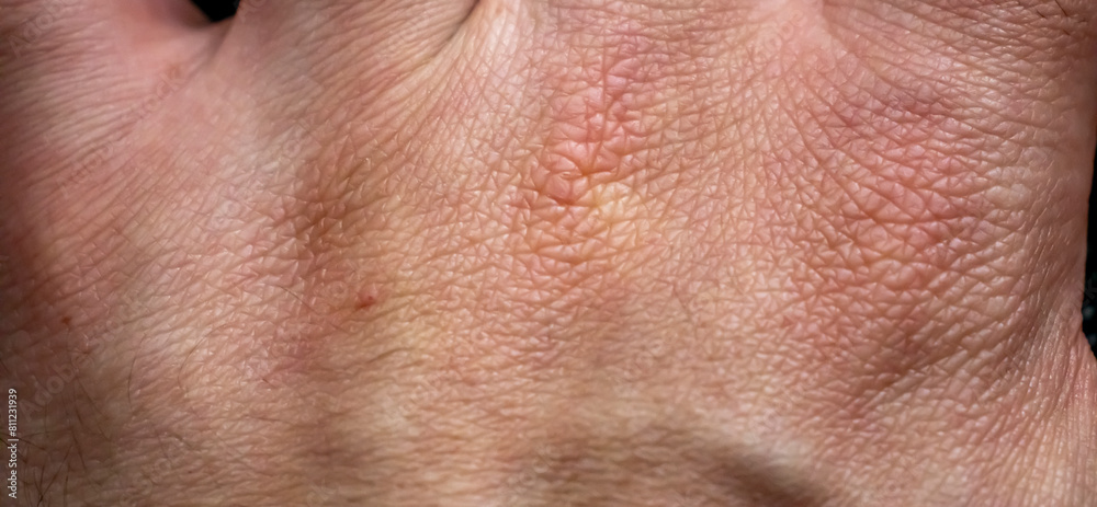 Human hand. Male skin pattern. Dermatology background. Health skin. Human hand. Male skin pattern. Dermatology background. Health skin.