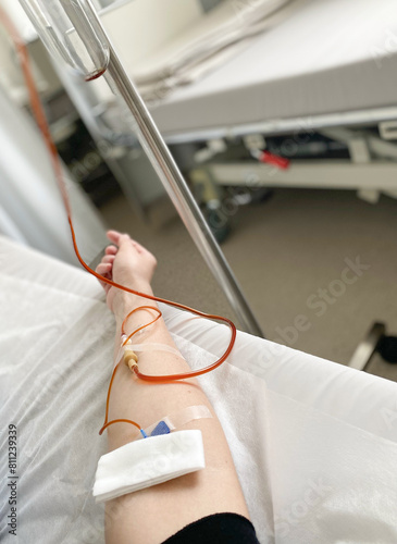 female hand with an IV in the clinic ward. Treatment of anemia in adults. Medical procedure in a hospital inpatient setting.